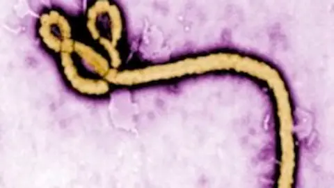 Virus del Ébola